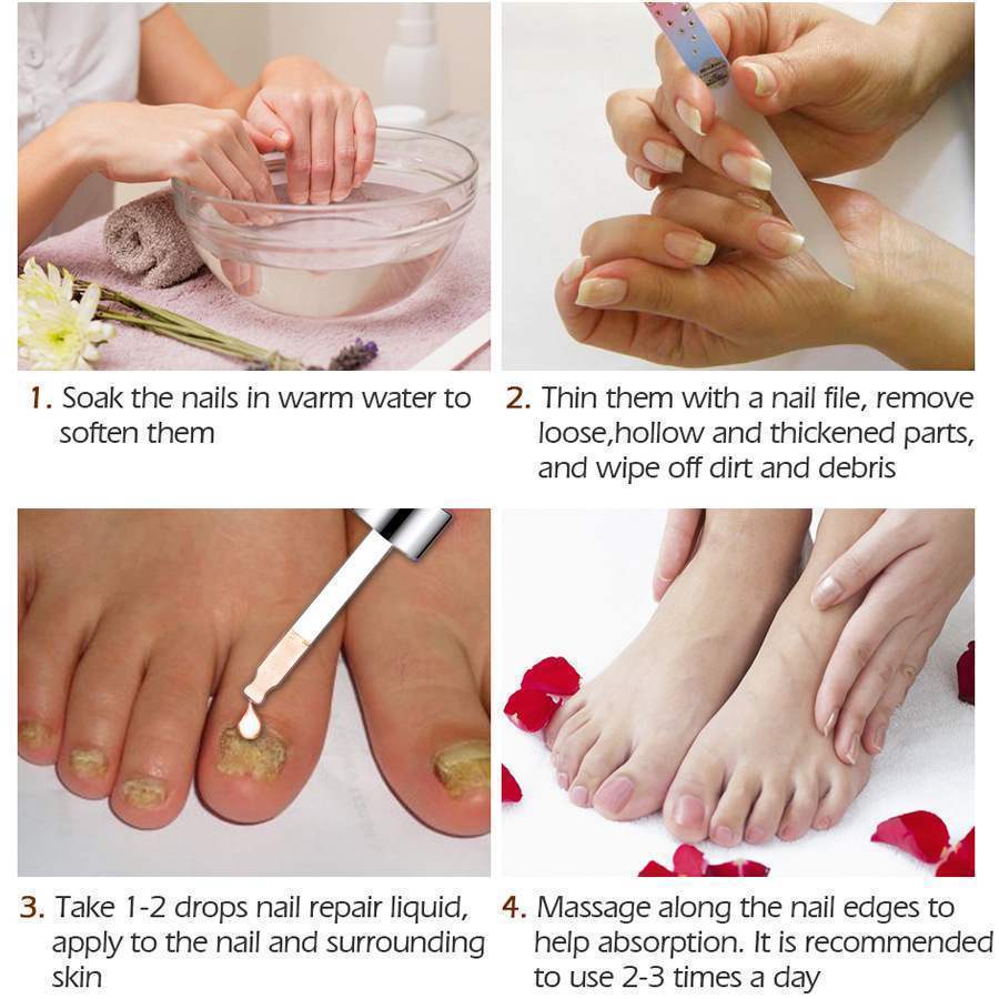 Vibrant Glamour Nail Repair Fluid Hand and Foot Nail Fungus Care Bright Nail