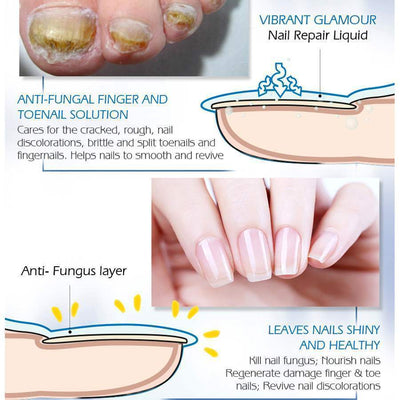 Vibrant Glamour Nail Repair Fluid Hand and Foot Nail Fungus Care Bright Nail